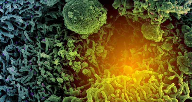 Variante Mu: o que a ciência sabe sobre a ‘nova’ mutação da Covid-19