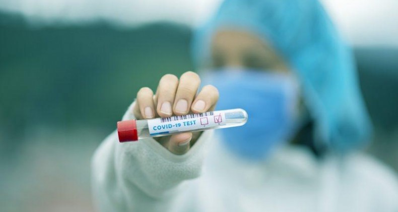 Novo teste para identificar Covid-19 é aprovado pela Anvisa